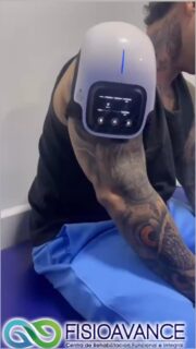 La tendinitis del supraespinoso es la inflamación que se ocasiona en este tendón por el roce provocado por los movimientos repetidos de elevación del hombro, que provoca un pinzamiento entre la cabeza del húmero y el arco acromial. Es la causa más frecuente de hombro doloroso.
Visítanos y deja tu salud en nuestras manos.
Agenda tu cita 📲 3012416898 o por WhatsApp en el siguiente link:
https://wa.me/+573012416898
Ubicación Calle 17 # 6-32 barrio Quirinal. Neiva
Página web www.fisioavanceips.com
#fisioavance #fisioterapianeiva #contracturas #liberacionmiofascial #masajes #aliviodolor #hombro #lesionesdehombro #lesionesdeportivasyrehabilitación #terapiafisica #neivahuila #Quiropraxia #quiropractico
#Neiva #fisioterapeuta #huilacolombia #saludneiva#manguitorotador#tendinitissupraespinoso