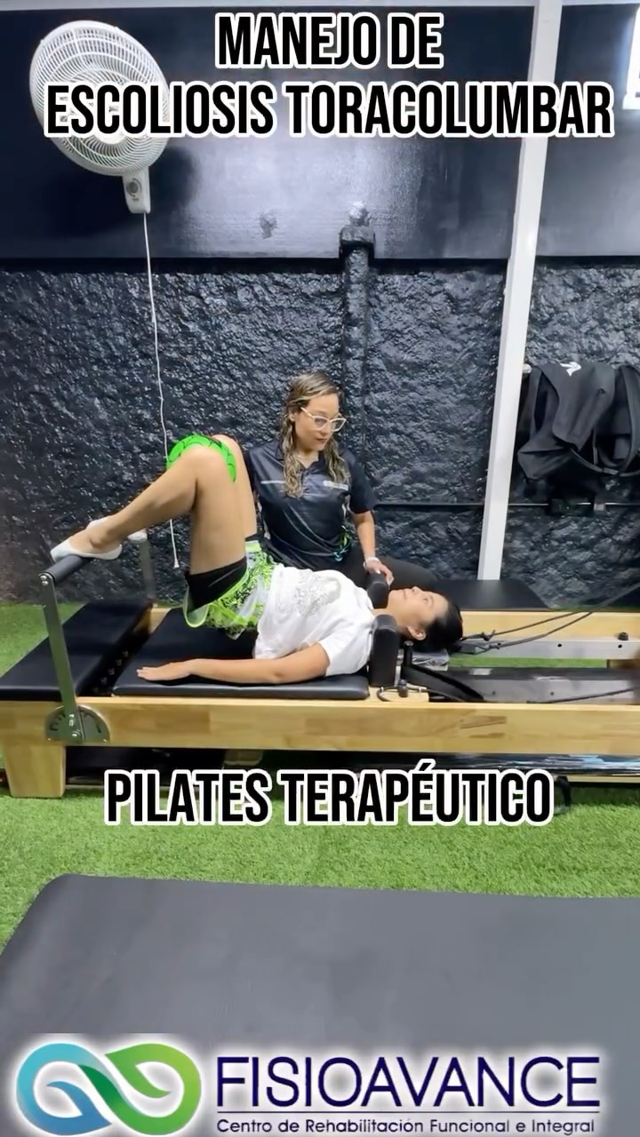En FISIOAVANCE trabajamos el Pilates Terapéutico como parte del proceso de rehabilitación de la escoliosis toracolumbar.
A través de ejercicios adaptados y supervisados por fisioterapia, buscamos mejorar la movilidad de la columna, fortalecer la musculatura estabilizadora, favorecer una mejor conciencia postural y optimizar el control corporal.
Cada tratamiento se adapta a las necesidades de la persona, teniendo en cuenta su grado de curvatura, movilidad, síntomas y condición física.
El objetivo no es solo realizar ejercicio, sino moverse de forma más segura, consciente y funcional, reduciendo sobrecargas y mejorando la calidad de vida.
📍 FISIOAVANCE
Pilates terapéutico y fisioterapia personalizada para cuidar tu columna.
Agenda tu cita 📲 3012416898 o por WhatsApp en el siguiente link:
https://wa.me/+573012416898
📍 Dirección: Calle 16 #7-55, Barrio Quirinal – Neiva
📲 Citas: 317 716 5551
📱 Síguenos en Facebook e Instagram: FISIOAVANCE IPS
#pilates #escoliosis #discopatias #fisioavance