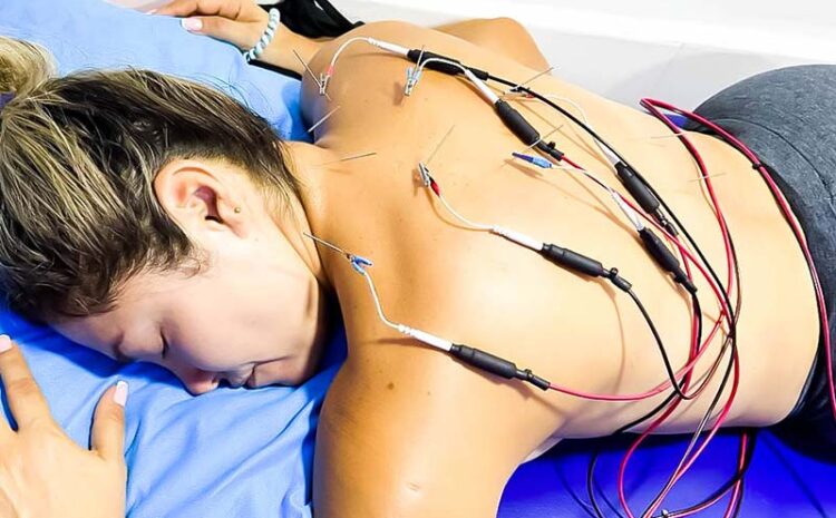 electroacupuntura2