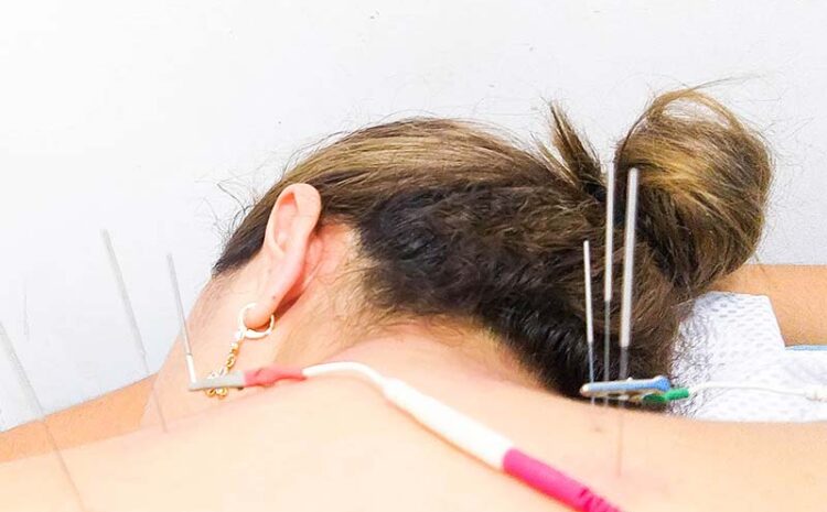 electroacupuntura3