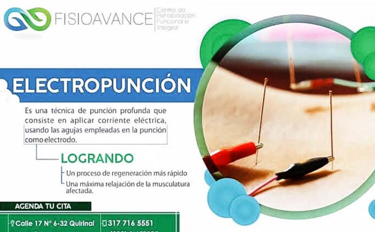 electroacupuntura5